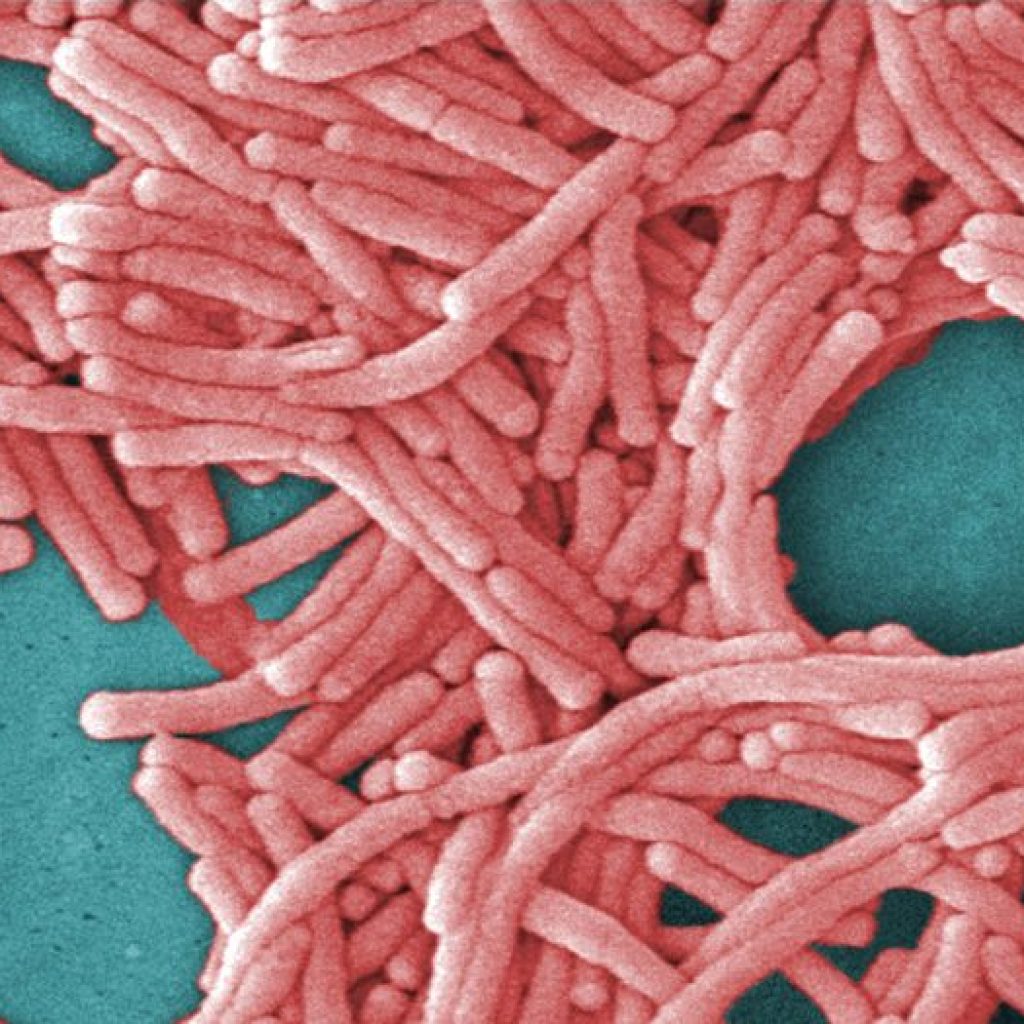 Fifth death reported in NYC Legionnaires’ outbreak