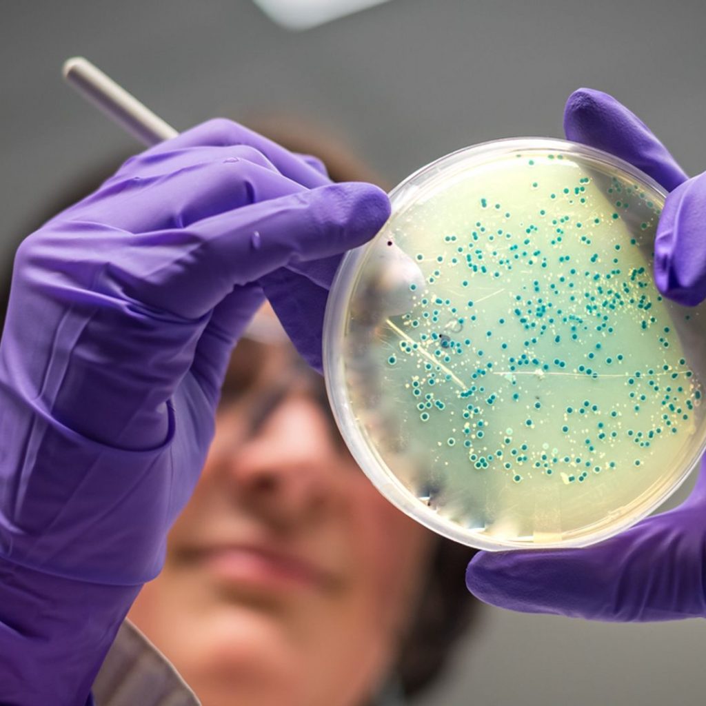 Salmonella outbreak linked to noodles affecting UK and 13
other countries