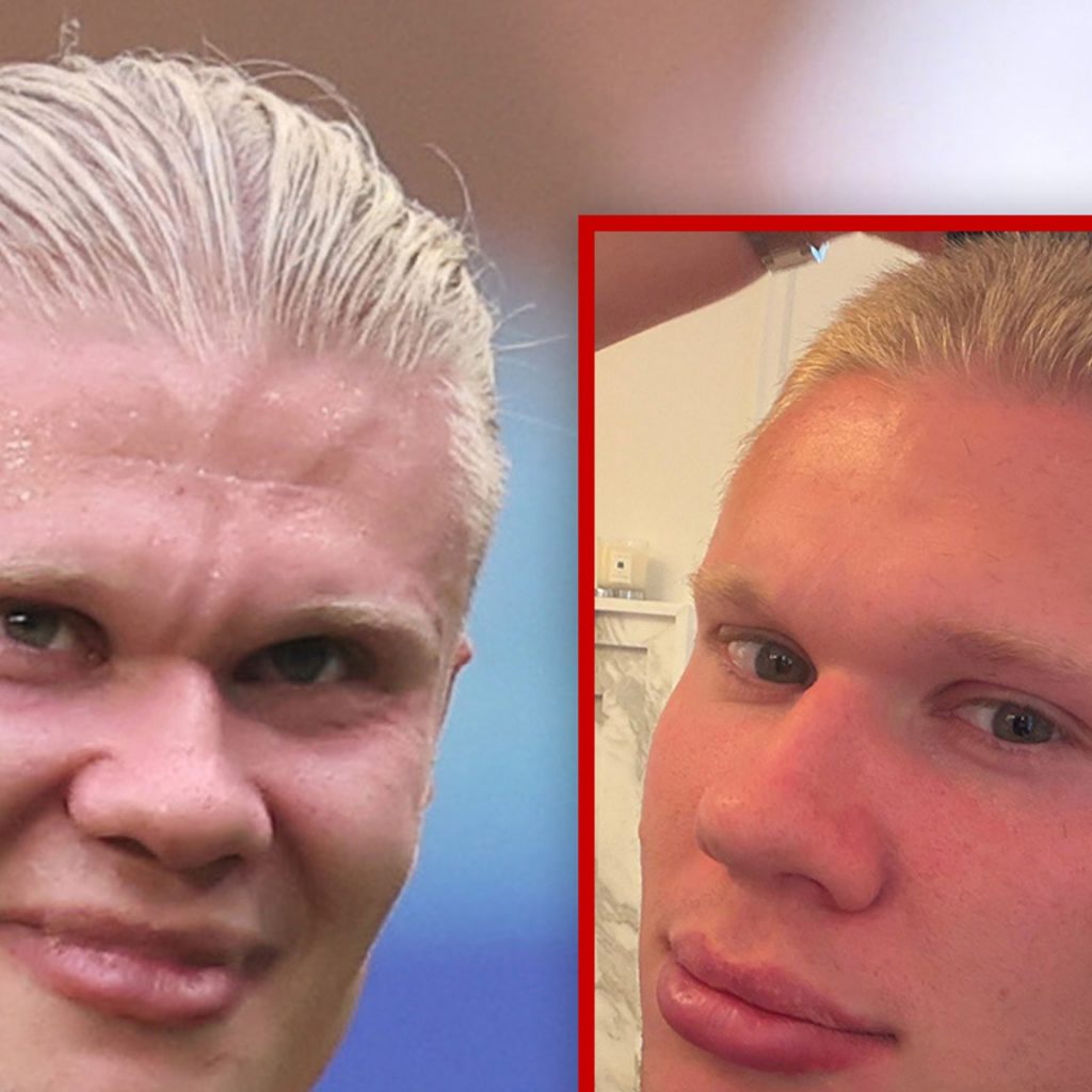 Erling Haaland Buzzes Off Iconic Blonde Hair