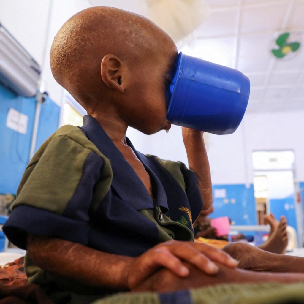 Somalia child hunger crisis deepens after aid cuts, UNICEF
says