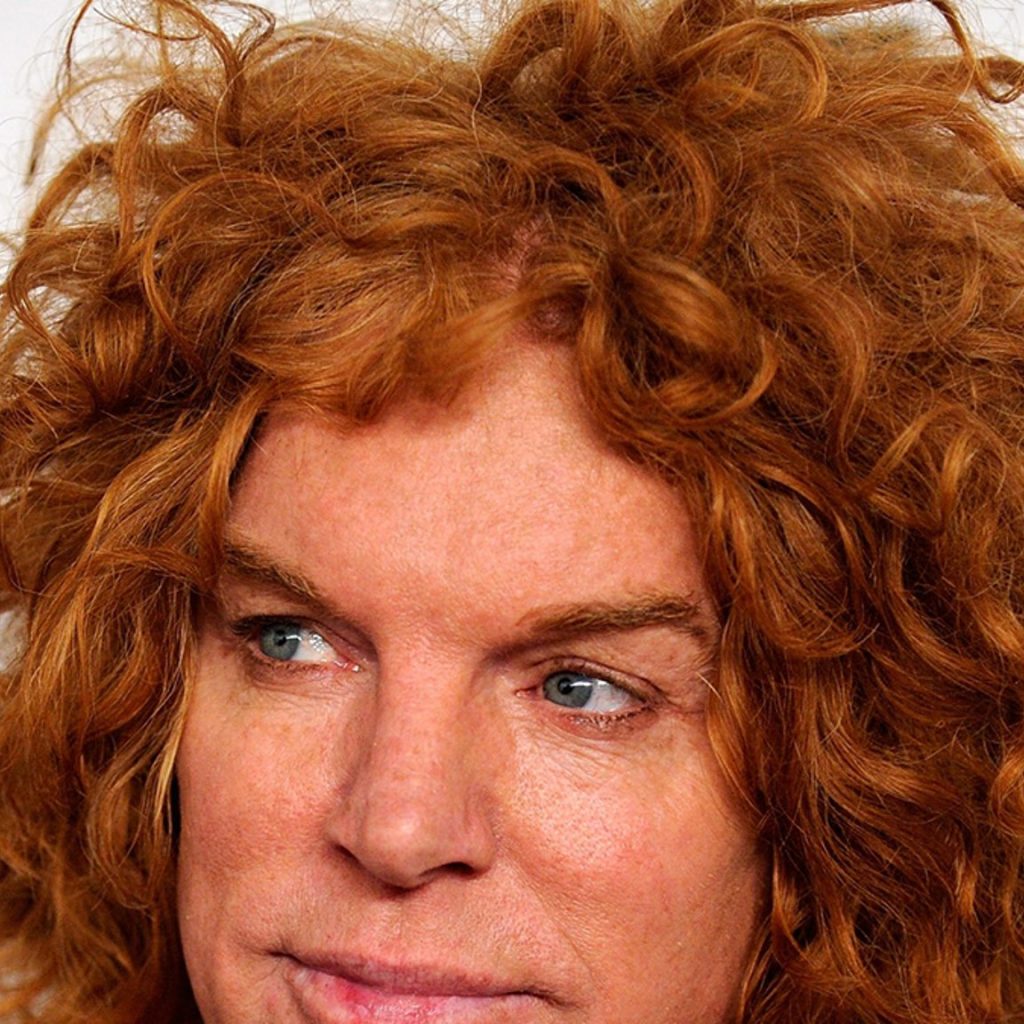 Carrot Top Is Now Awake, Breathing On His Own