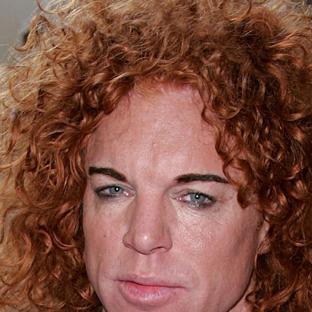 Carrot Top Reportedly Doing Better, Released From
Hospital