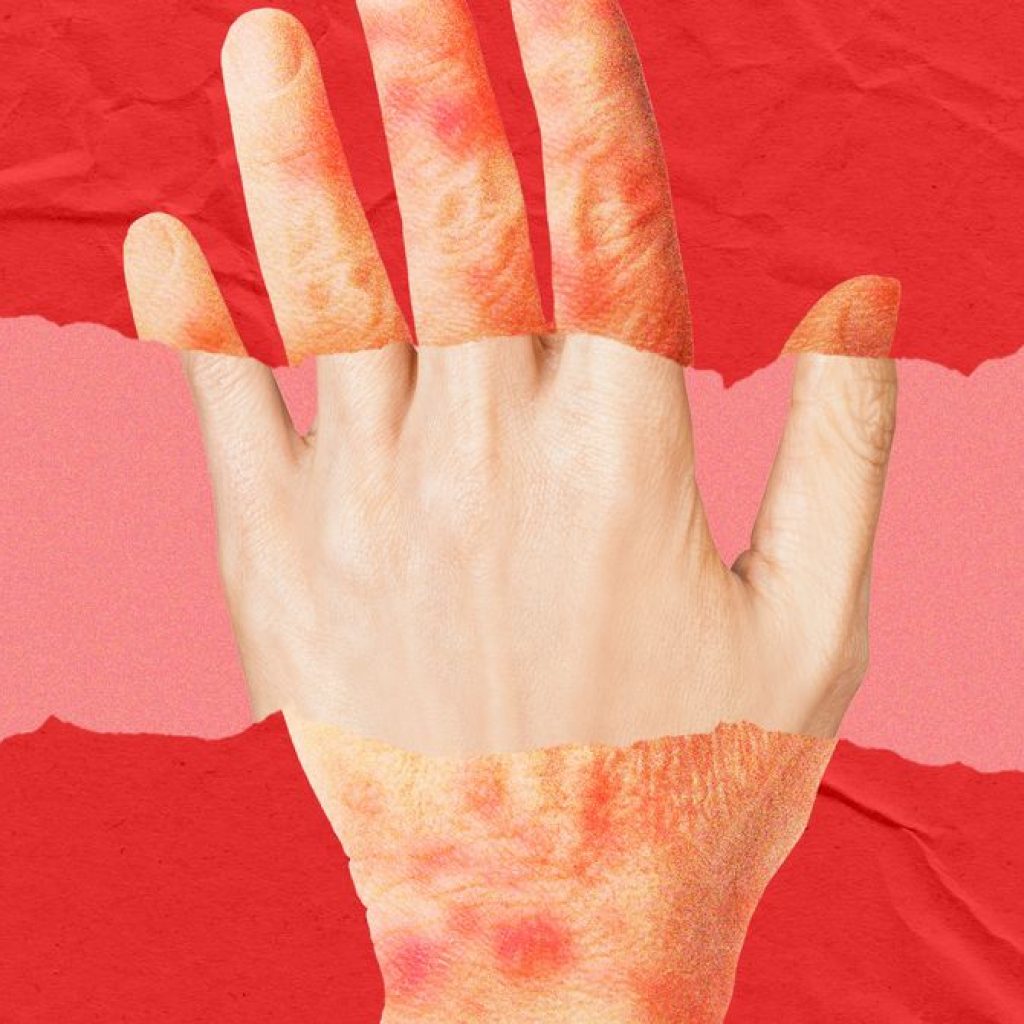 A New Anti-Aging Drug Looks to Turn Back the Clock on Skin
Age