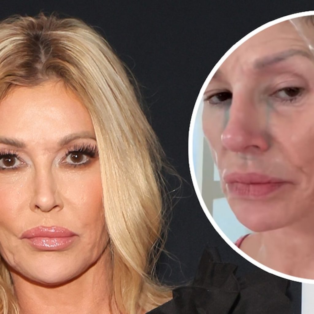 Brandi Glanville Getting Surgery to Find Out What’s “Eating”
Her Face