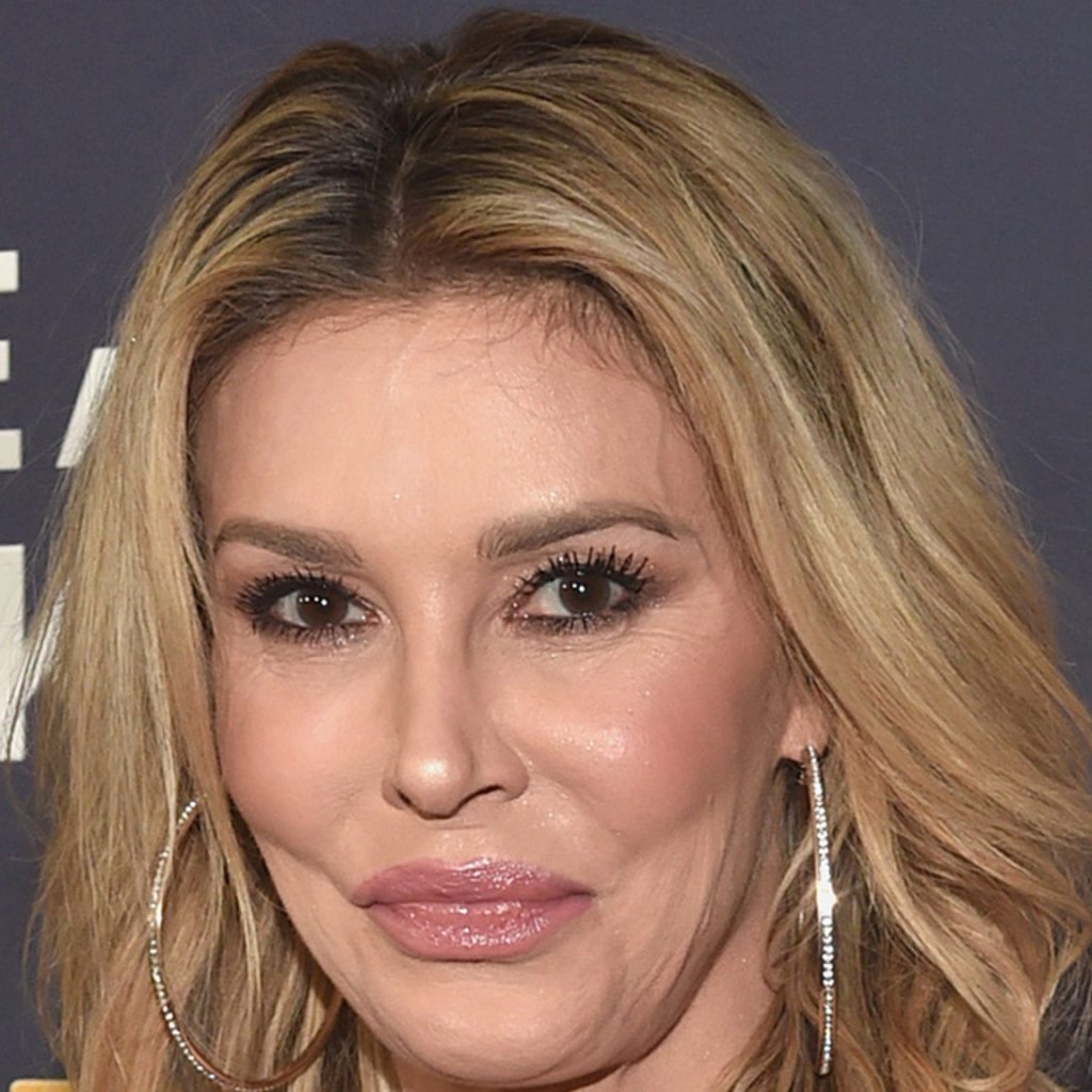 Brandi Glanville’s Ear Was Not Removed Despite Alarming
Social Media Post