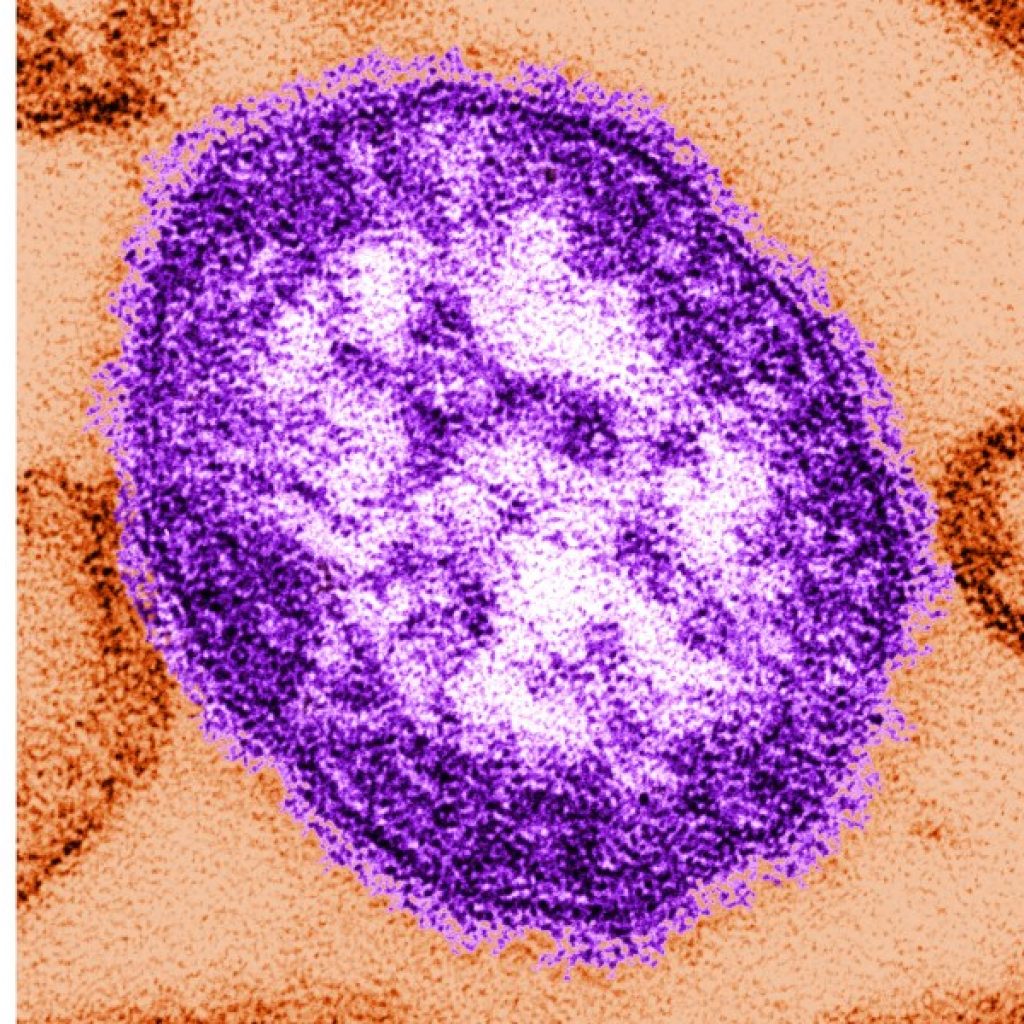 Pennsylvania reports sixth measles death