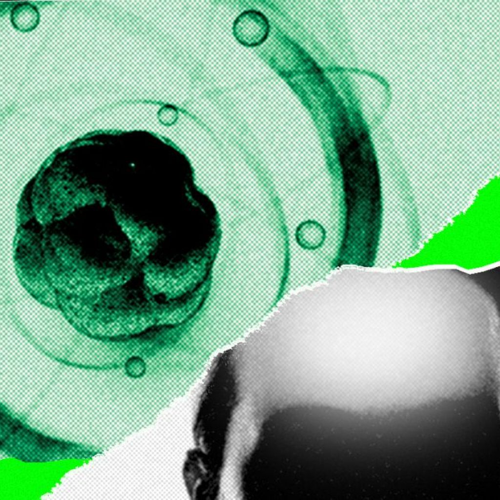 AI Came for Math. Now It’s Chasing the Rest of
Science