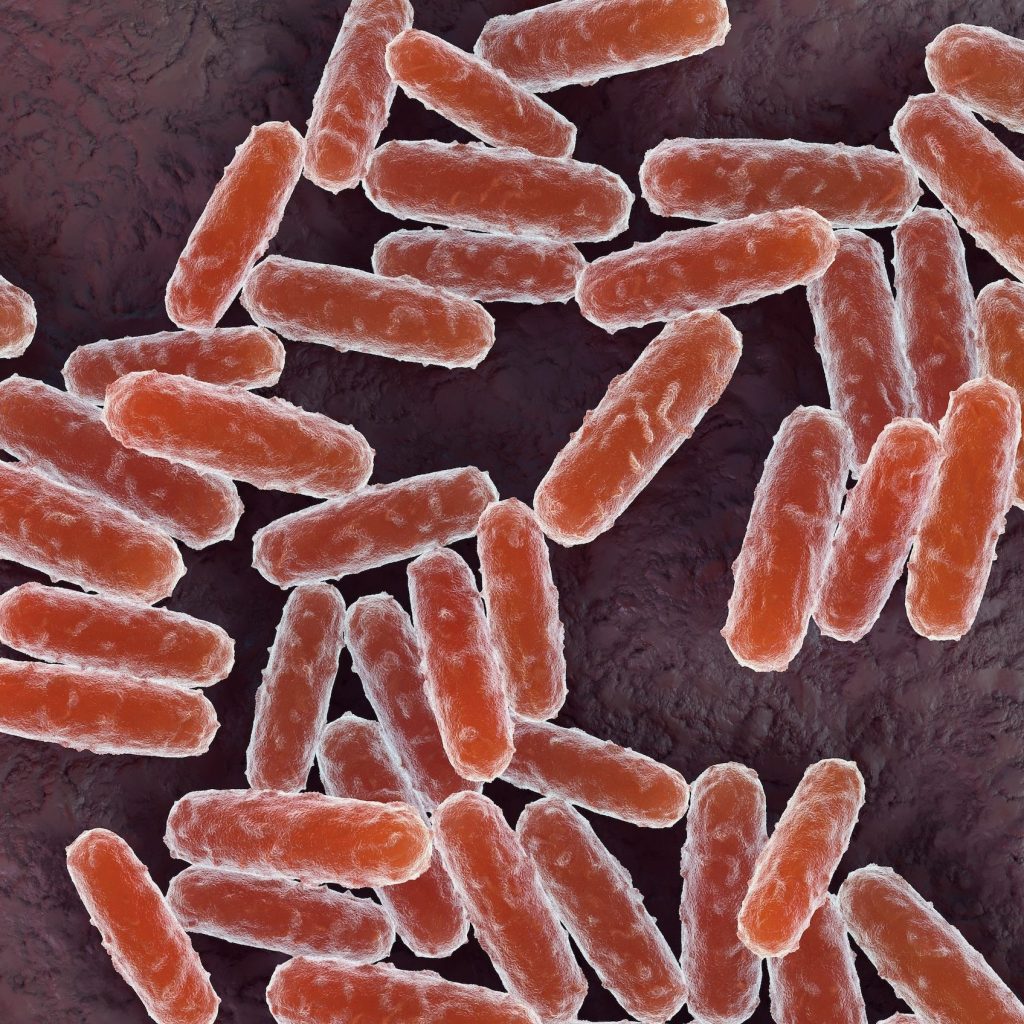 Is Pneumonic Plague in America? What to Know as the
Infection Spreads in Russia