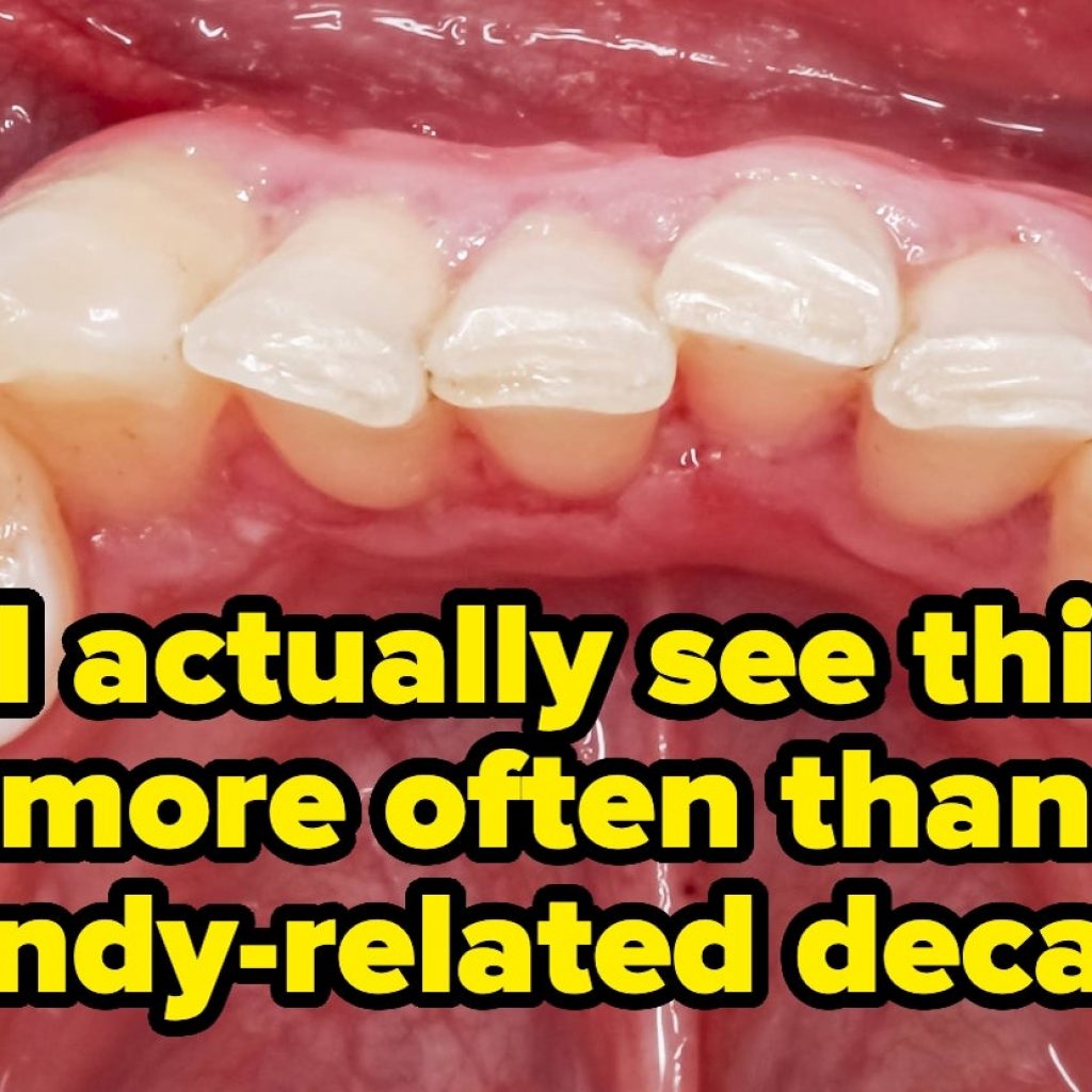 “That Surprises Parents”: Dentists Are Begging You To Cut Back On This Snack That Can Basically Turn Your Teeth Into Swiss Cheese