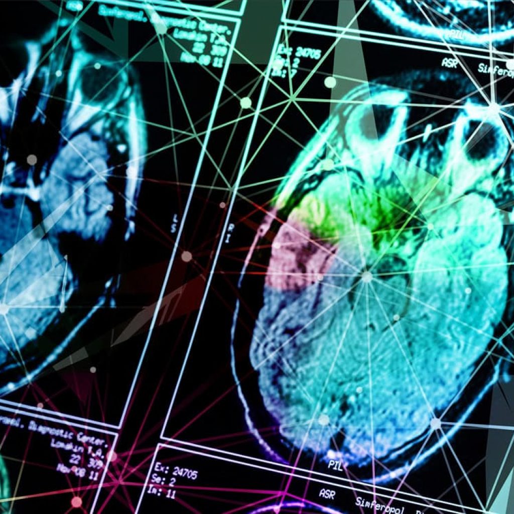 Childhood abuse is linked to distinct brain differences depending on age, sex, and type of maltreatment