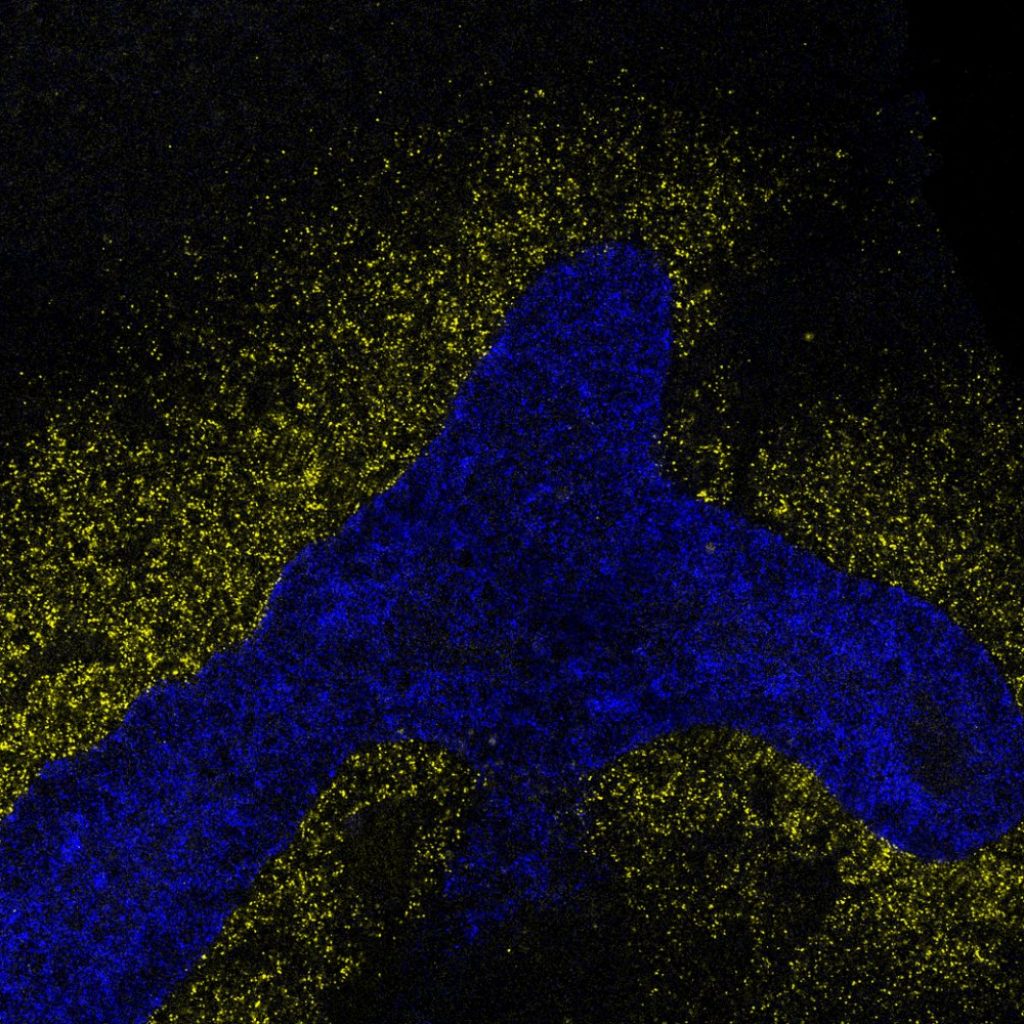 AI model decodes the language cells use to
communicate