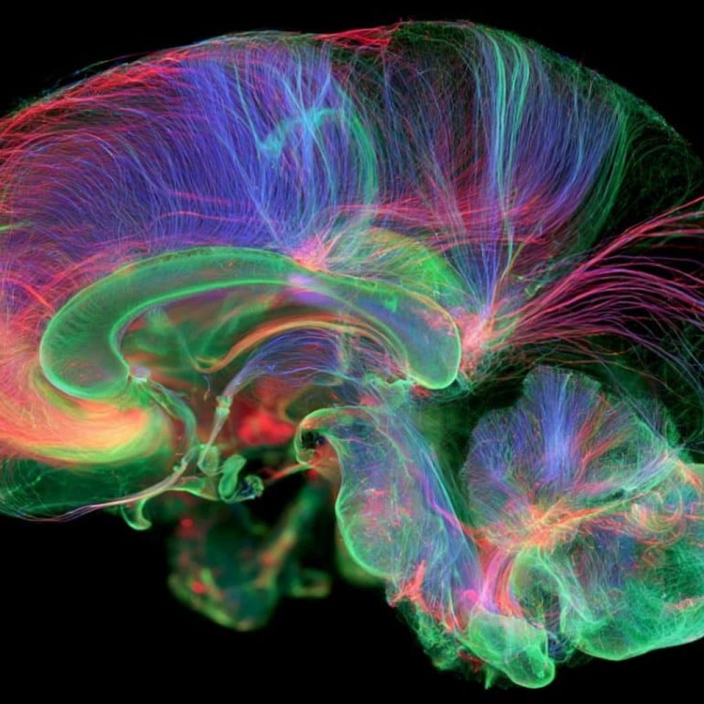 Premature Birth Alters Cerebellar Wiring