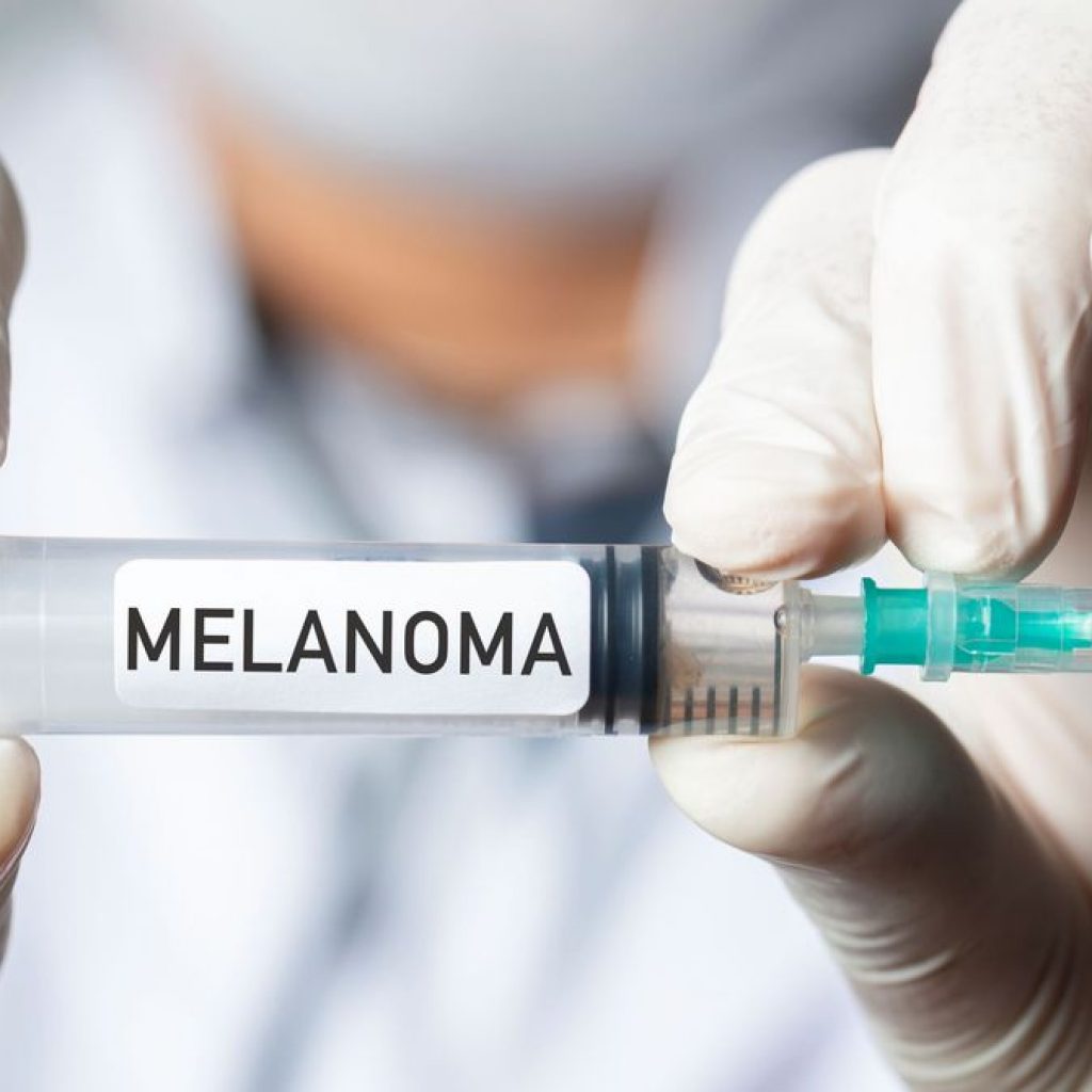New mRNA Vaccine Reduces Risk of Melanoma Recurrence by Over
40 Percent